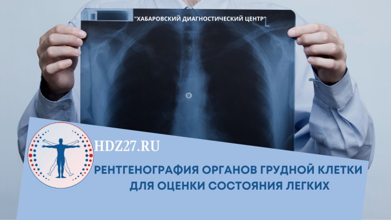 Рентген органов грудной клетки в Хабаровске